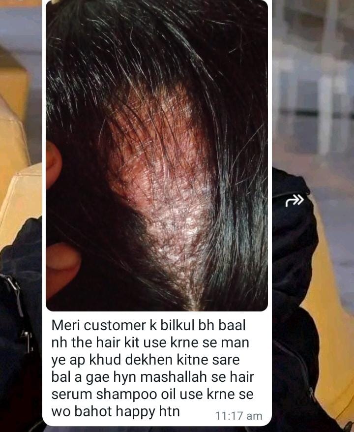 Hair Growth Serum