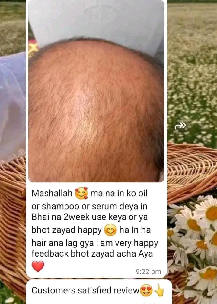 Hair Growth Serum