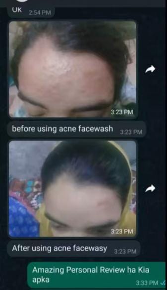 Salicylic Anti-Acne Face Wash