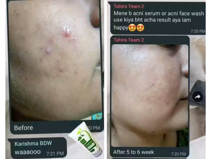 Salicylic Anti-Acne Face Wash
